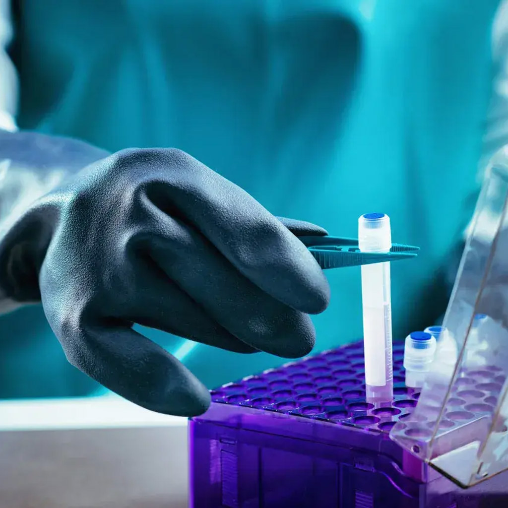 Criopreservación de células madre