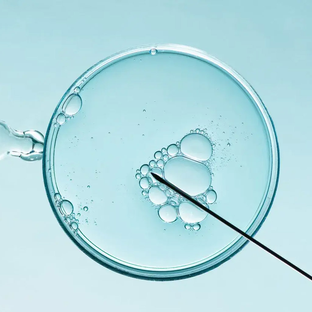 Reproducción asistida